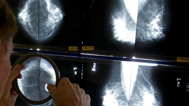 Une étude suggère un dépistage moins fréquent pour les survivantes du cancer du sein