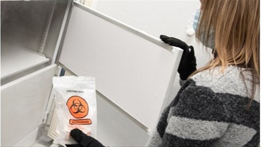 Un microbiote intestinal en santé améliore l'effet de l'immunothérapie